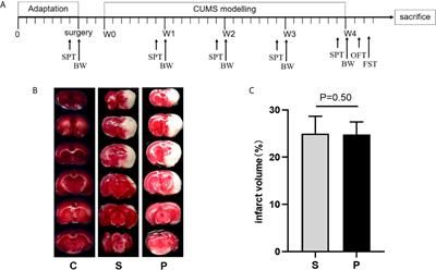 Alteration of Gut Microbiome and Correlated Lipid Metabolism in Post-Stroke Depression